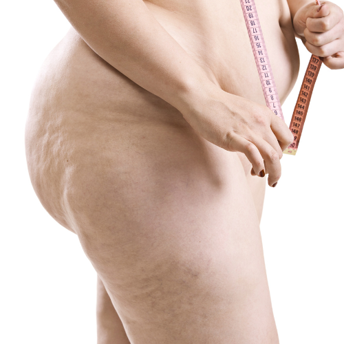 Lipo express / sem corte